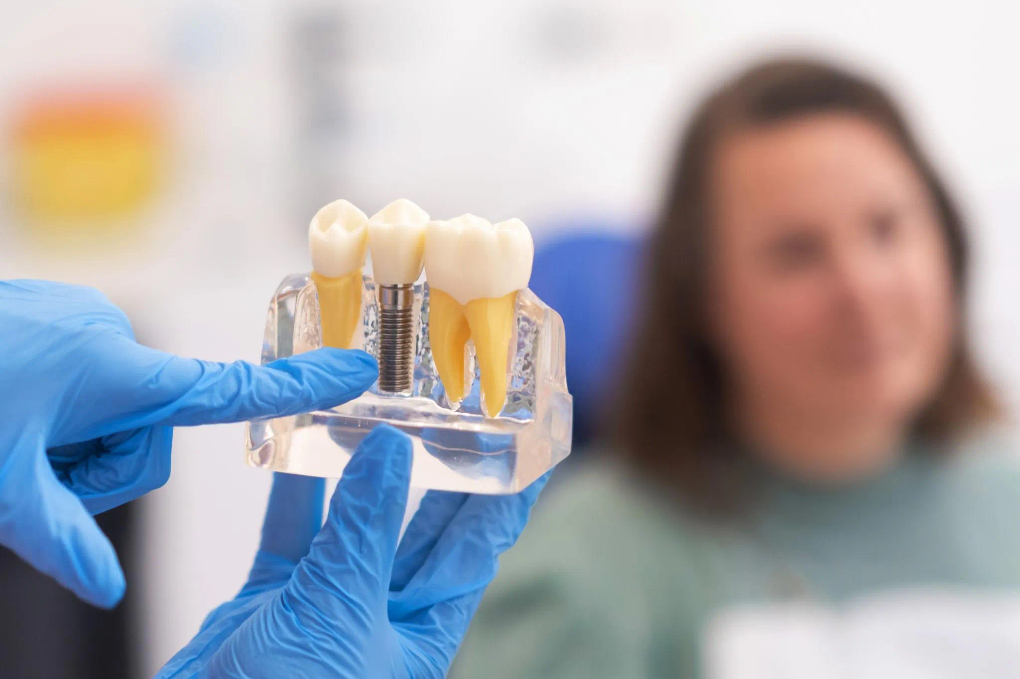 How Long Does A Dental Implant Last?