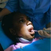 3D Scans for Dental Implants