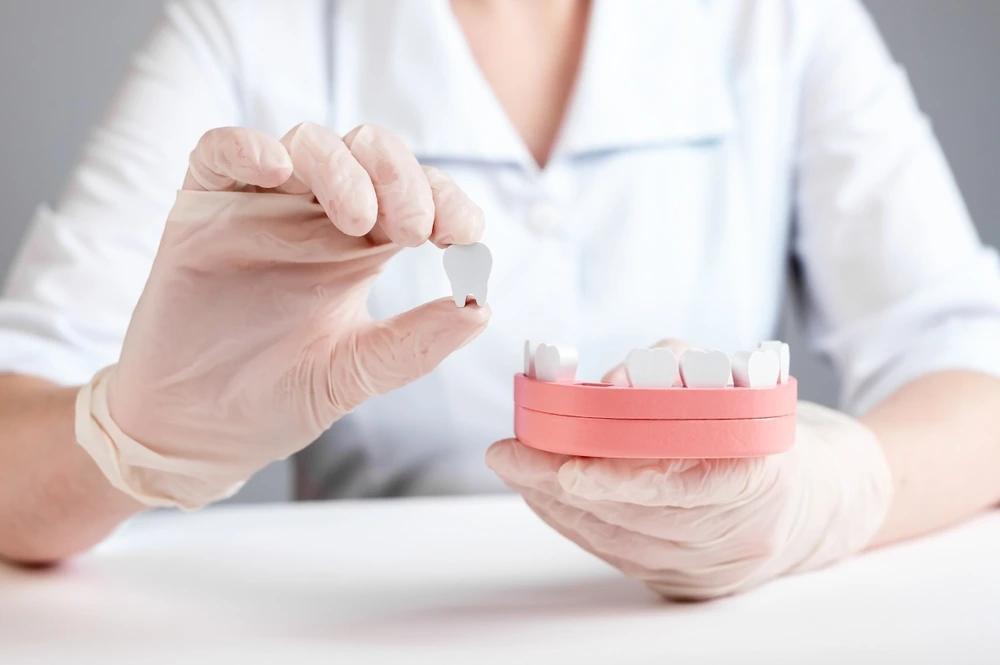 Damaged Teeth with Custom Restorations