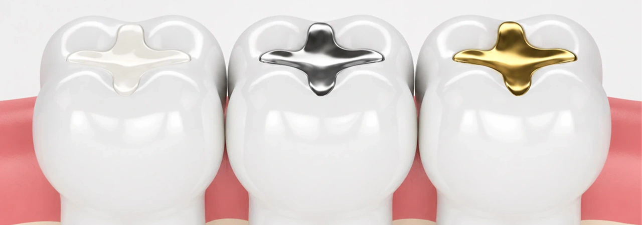 Dental Filling