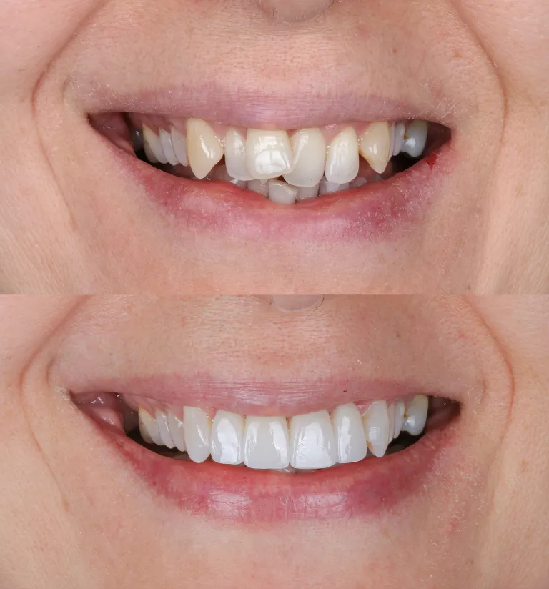 What’s Your Ideal Smile?