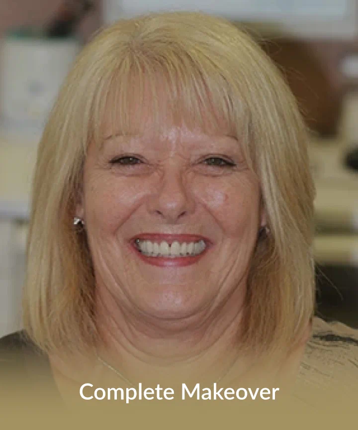Makeover