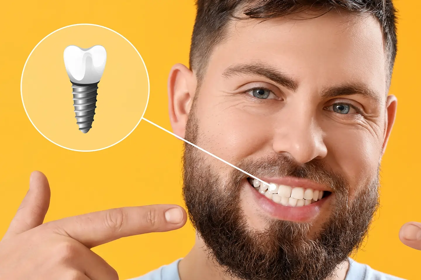 Dental Implants Vs. Dentures|Glendale Heights Family Dental