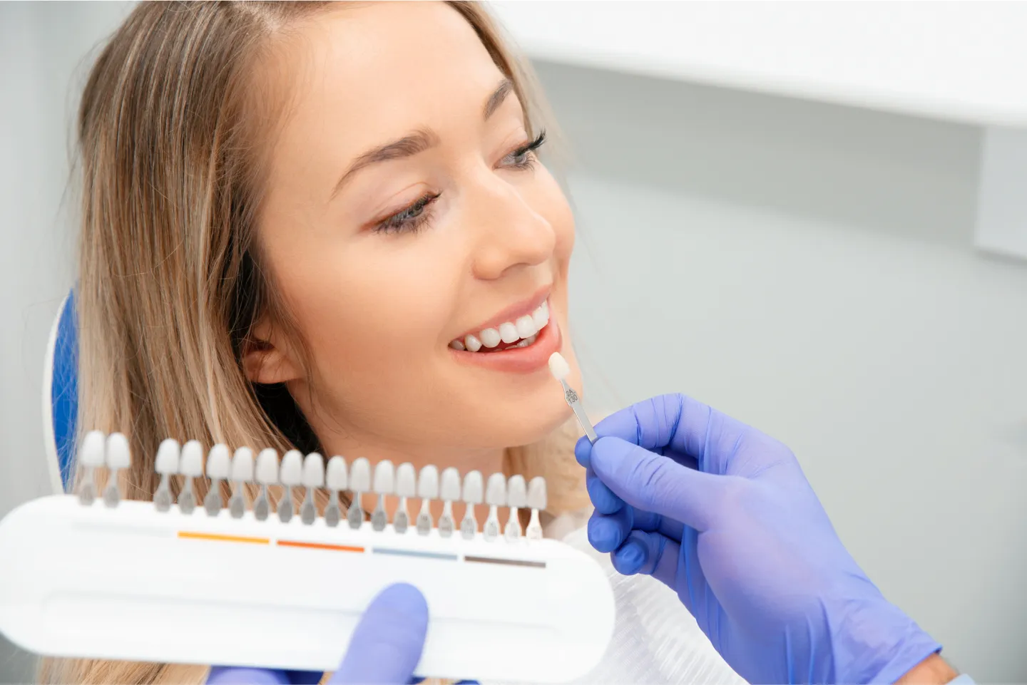 Dental Veneers