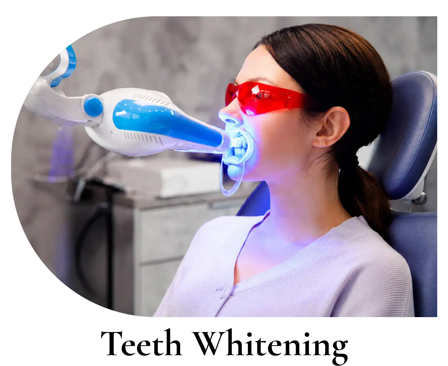 Teeth Whitening