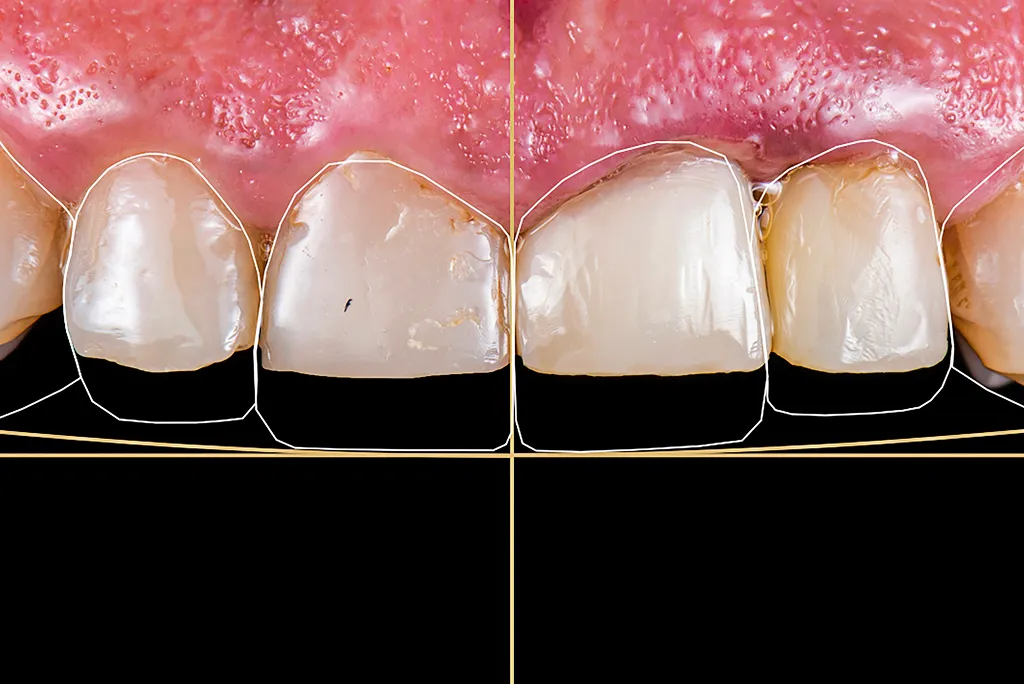 Man sitting at the dentists