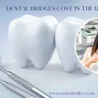 Dental Bridges Cost in the UK