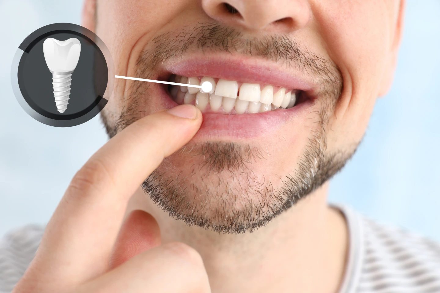 Asking Your Dentist If Dental Implants Are Right for You