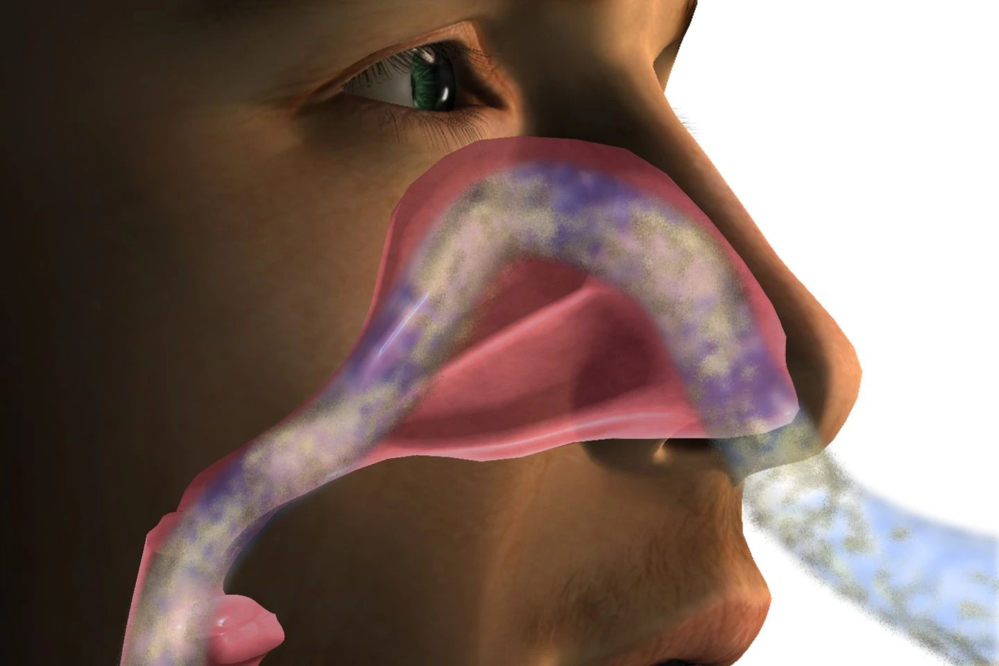 Sleep Apnea