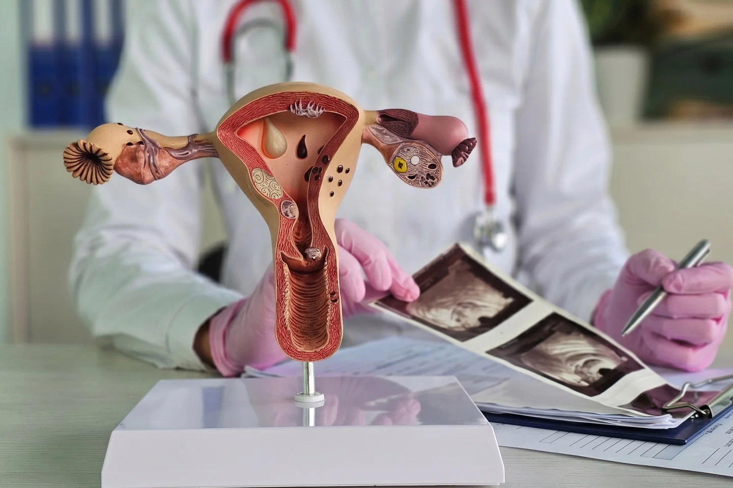 Gynaecologic Cancer Diagnosis & Treatment
