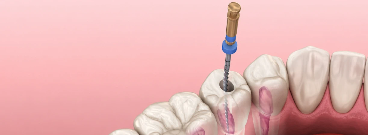 Restorative Dentistry