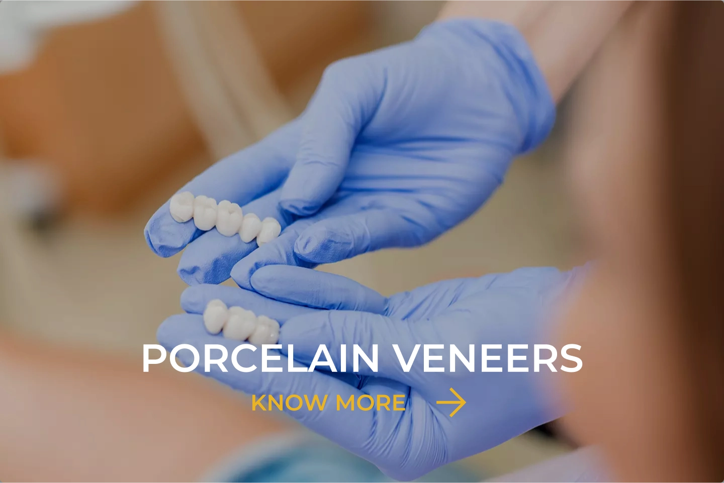 Porcelain Veneers