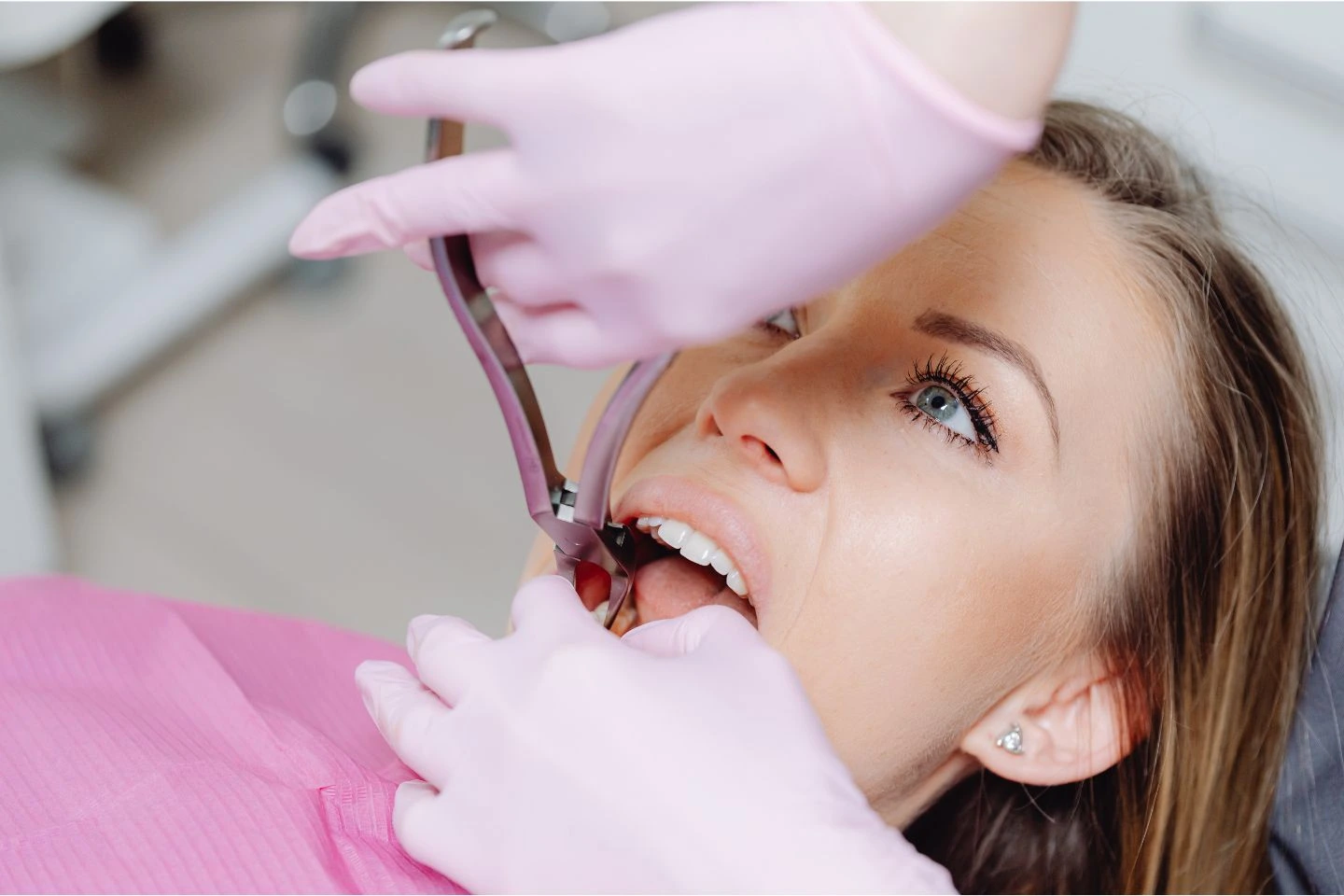 Root Canal Treatment