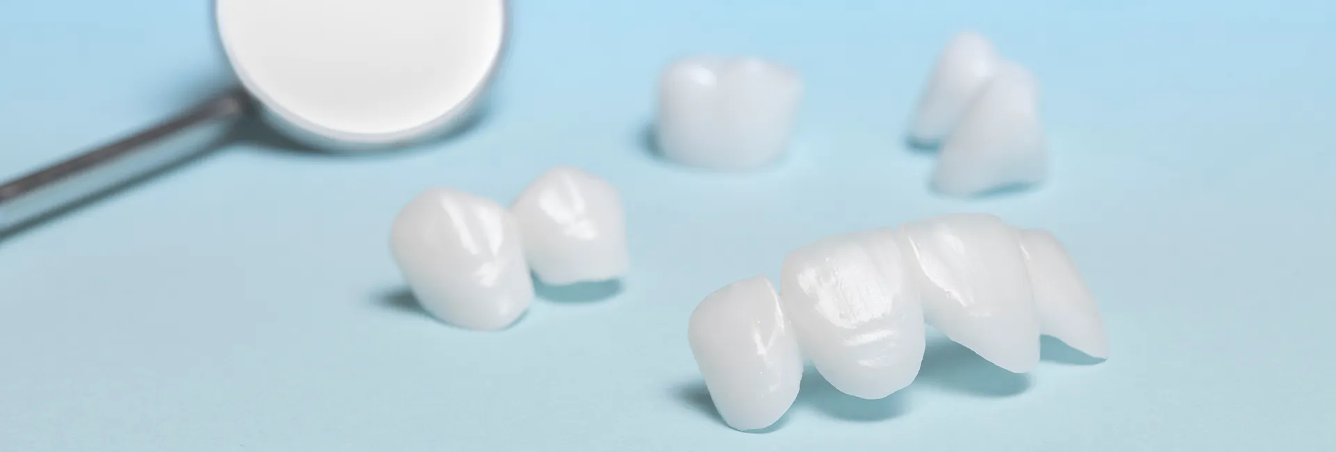 Veneers