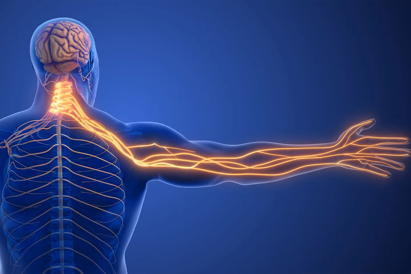 Cervical Radiculopathy