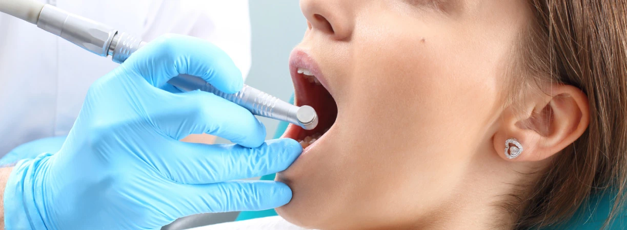 Root Canal