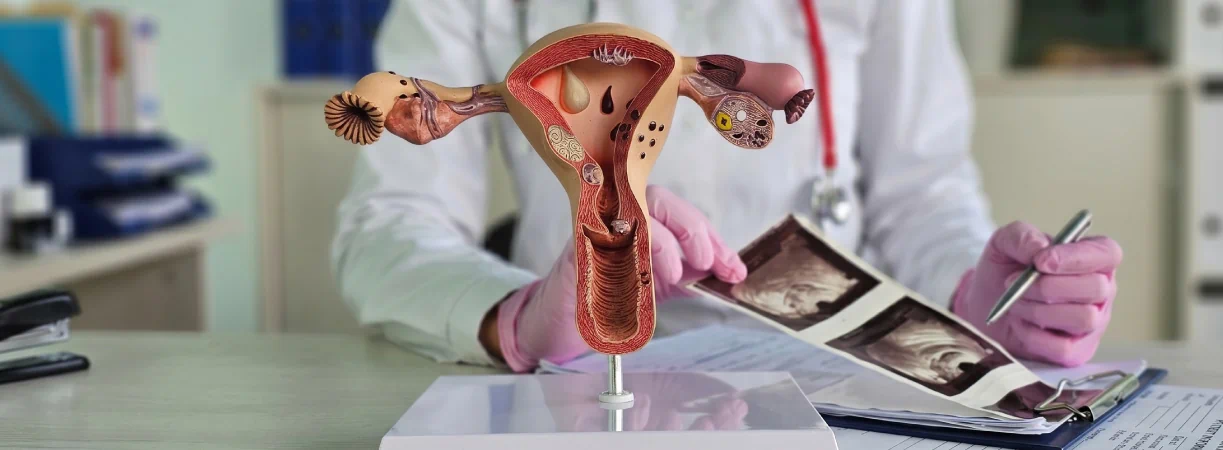 Gynaecologic Cancer Diagnosis & Treatment