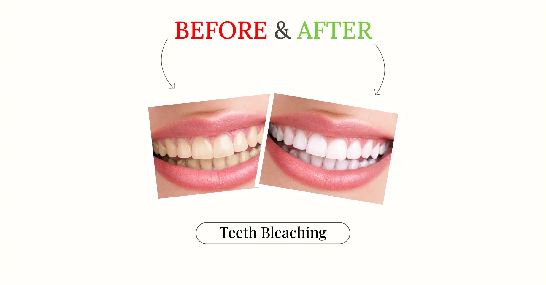 Generating Bright Smiles at Sacramento West Dental Office, CA
