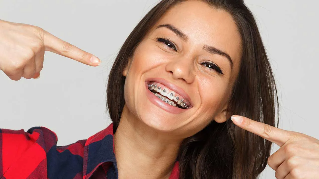 Traditional Metal Braces - A Timeless Solution For A Perfect Smile
