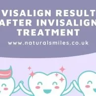 Invisalign Results: After Invisalign Treatment