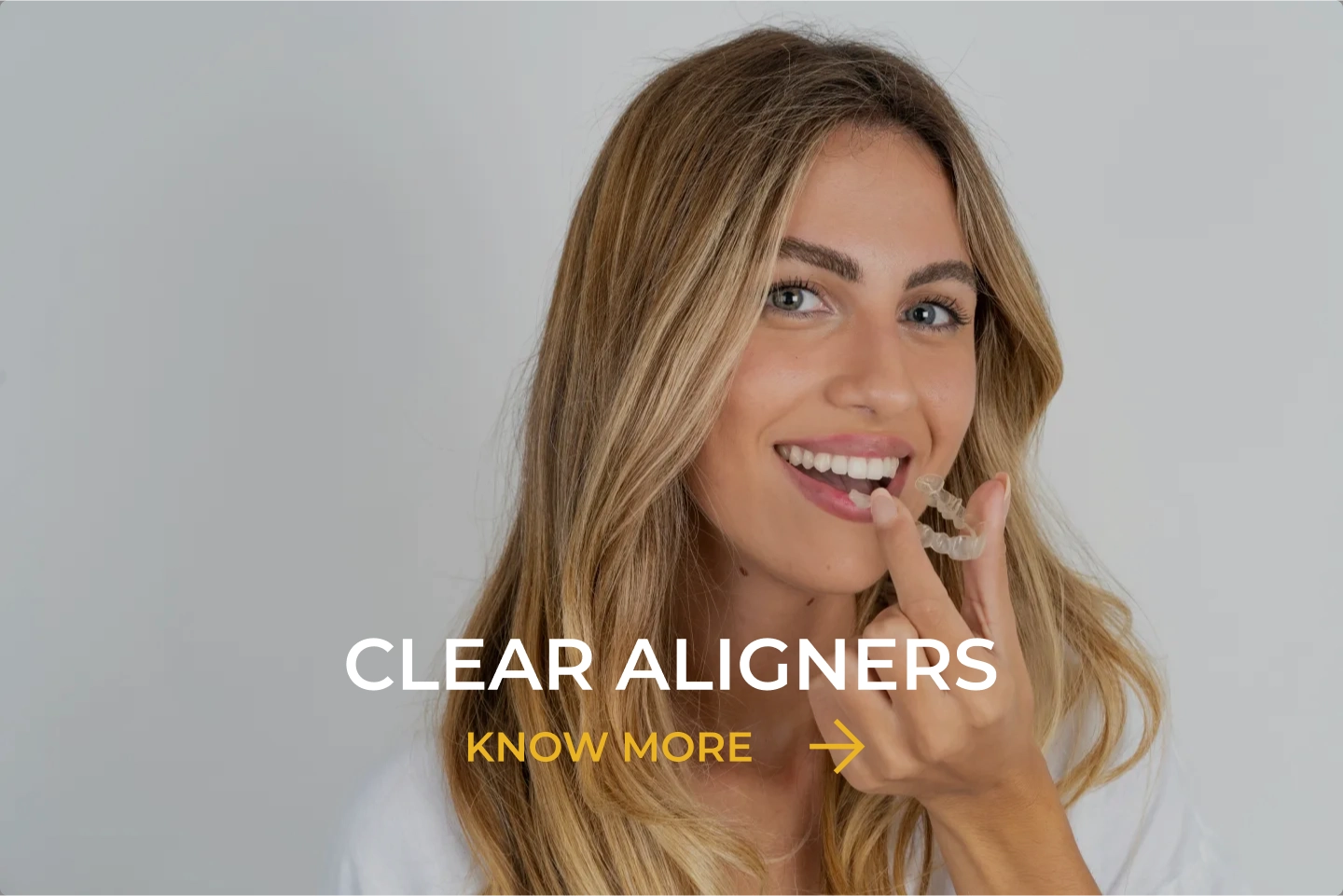 Clear aligner