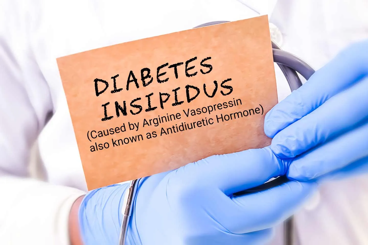 Diabetes Insipidus