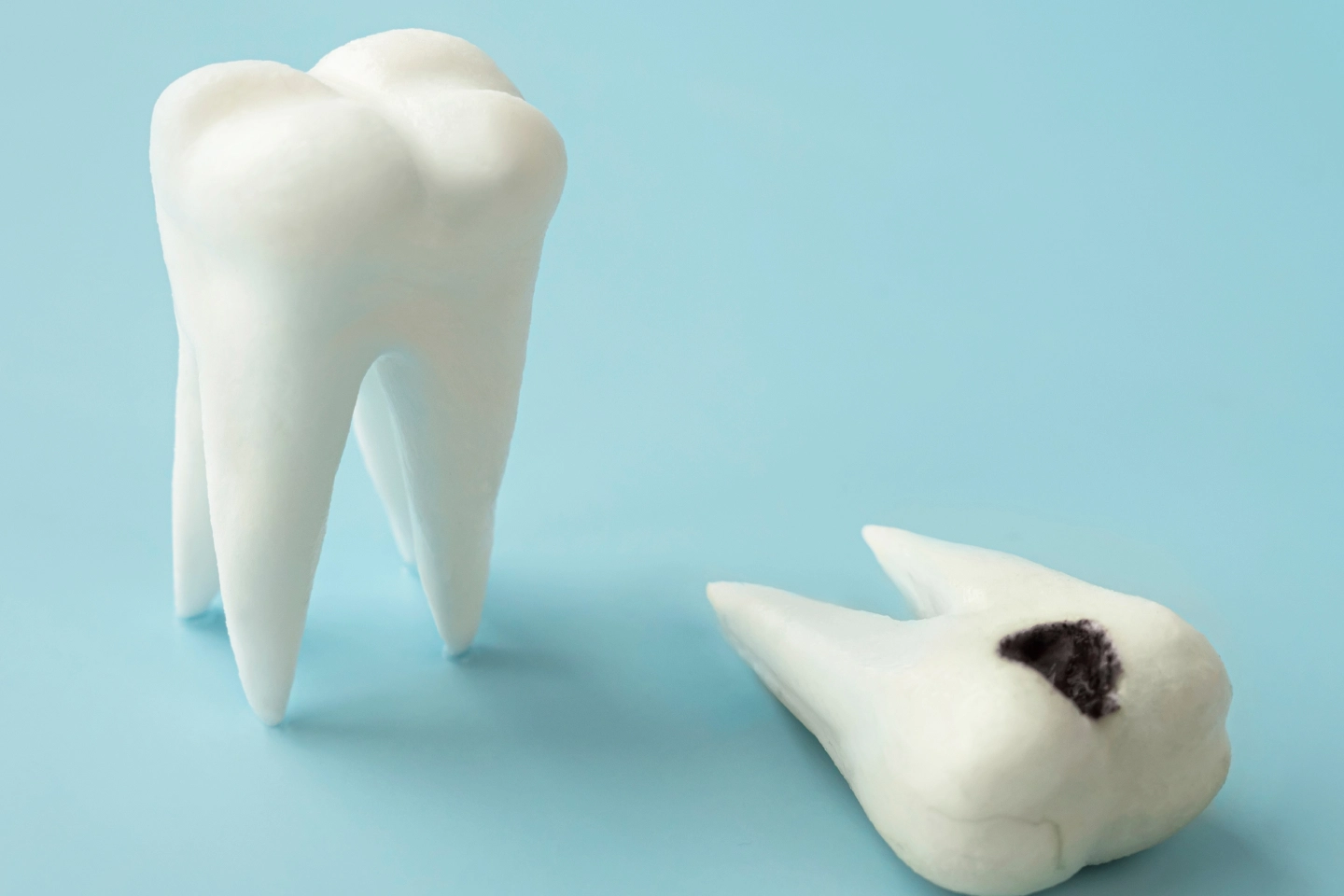 Dental Caries: Complications And Treatment