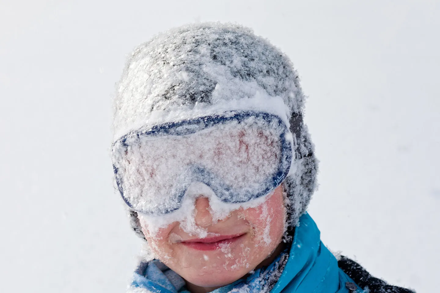 Don’t Let Snow Blindness Ruin Your Winter Vacation