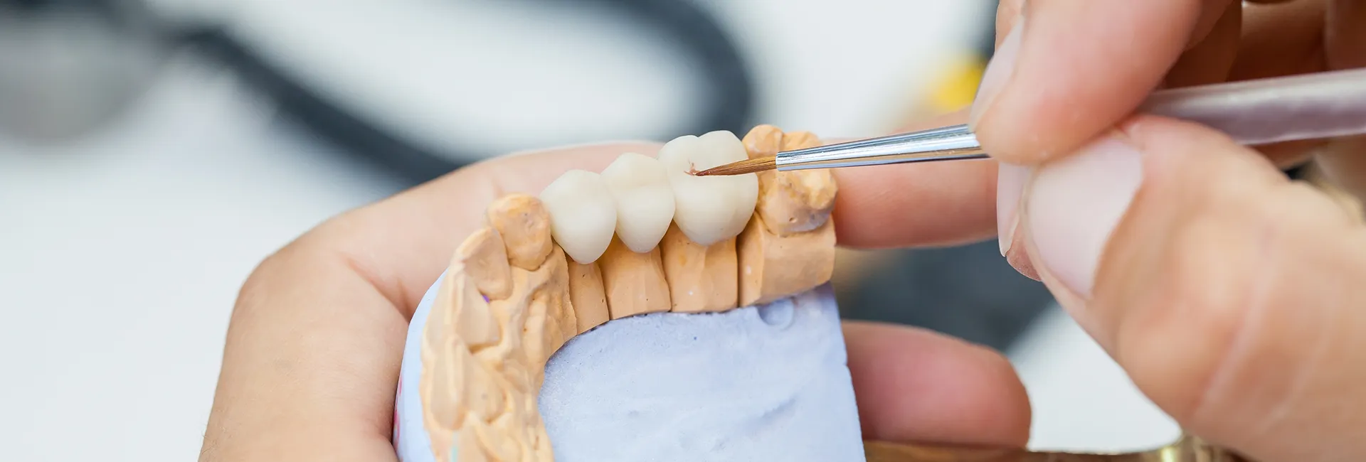 What Is the Procedure and Purpose of a Dental Crown?