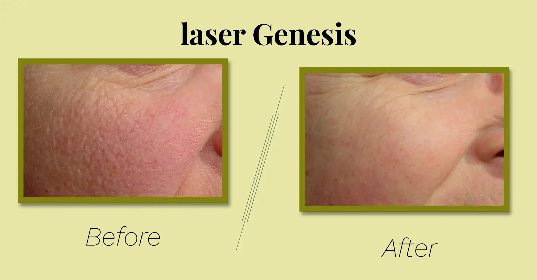 Photo Courtesy of Kevin Smith, MD, FRCPC, dermatology