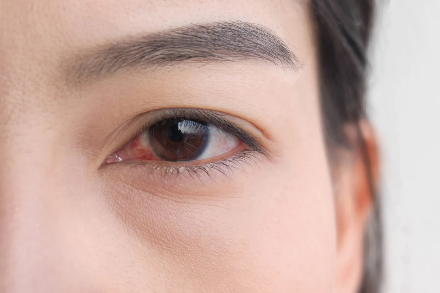 Sjogren’s Awareness – Understanding The Invisible Disease