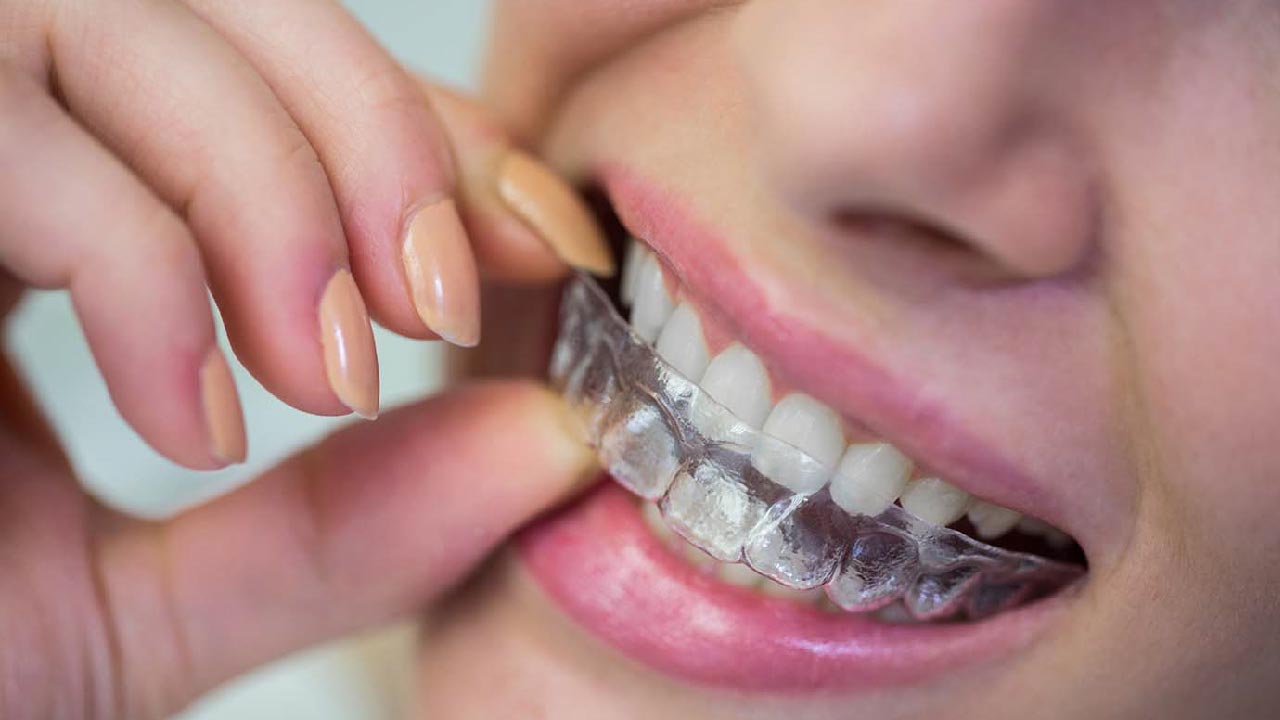 Invisalign Treatment for Crooked Teeth in Henderson