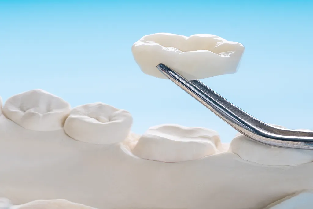 Dental Crowns in Hoffman Estates, IL