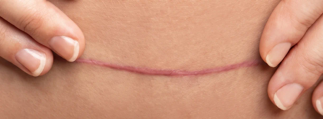 Surgical Procedures