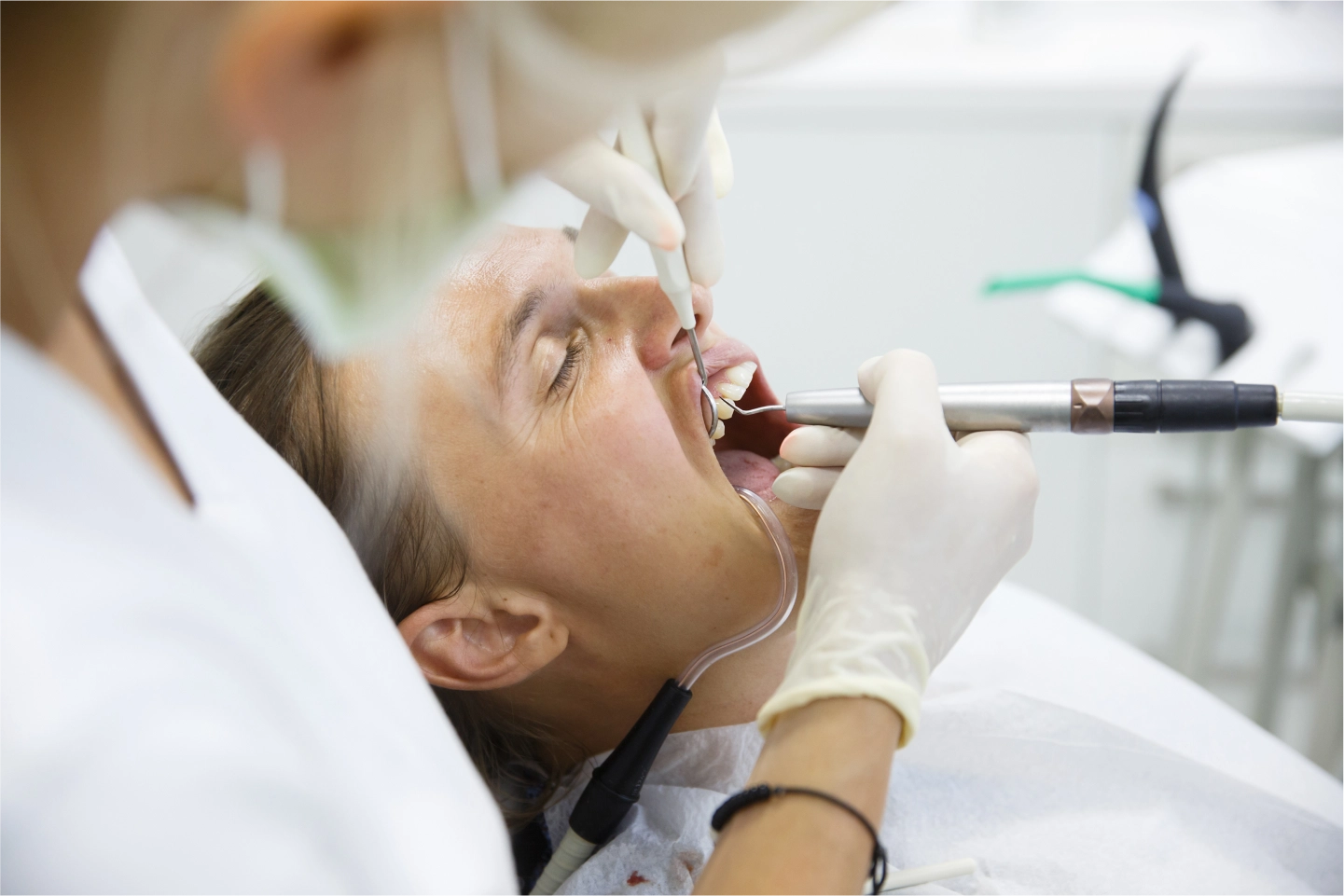 Root Canal Treatment And Its Impact On Overall Health