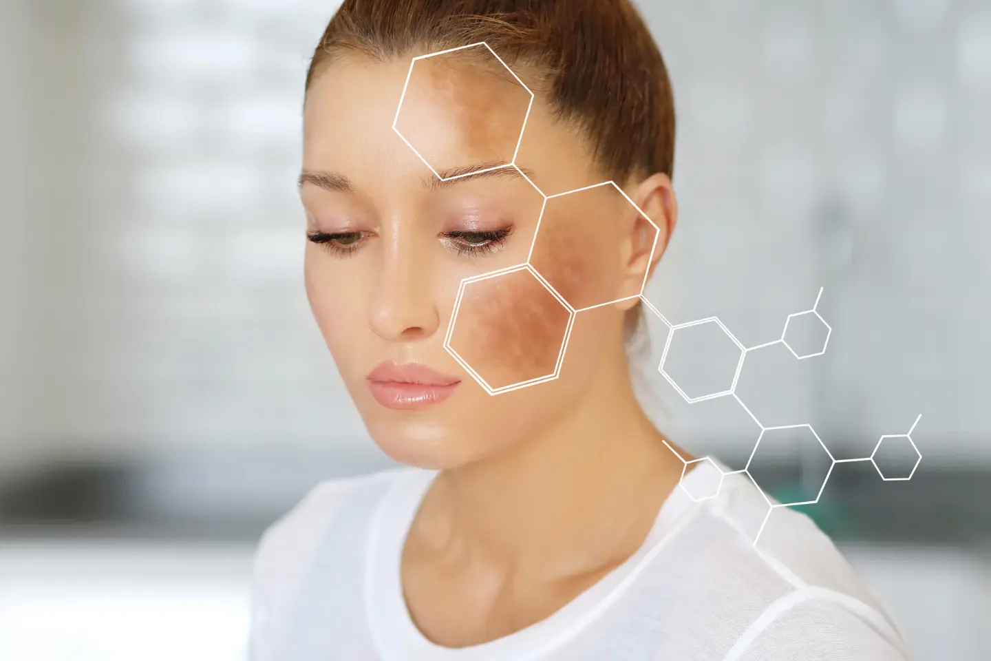 Hidden Dangers of Sun Exposure