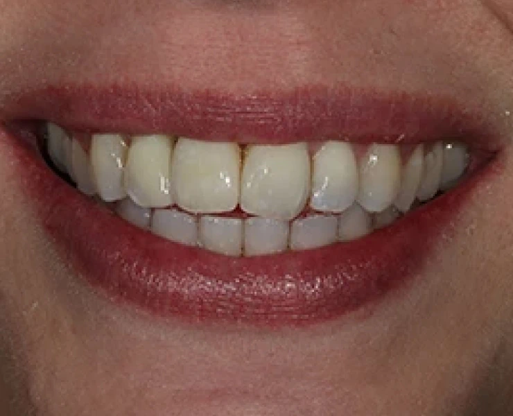 main-image