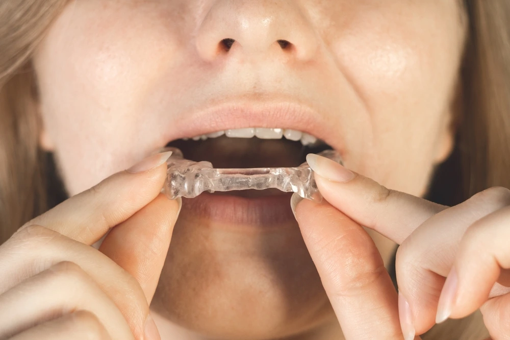 Retainer icon showing a transparent tray on white background
