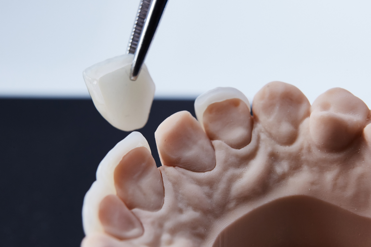 Icon of a healthy tooth with a crown symbol above it indicating restoration and protection.
