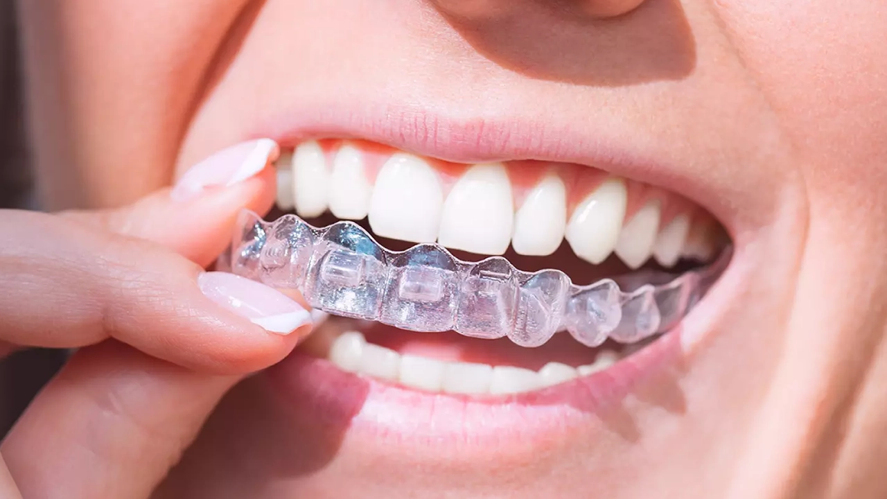 TMD Chino, California Dr. Rakesh Patel DDS 91710