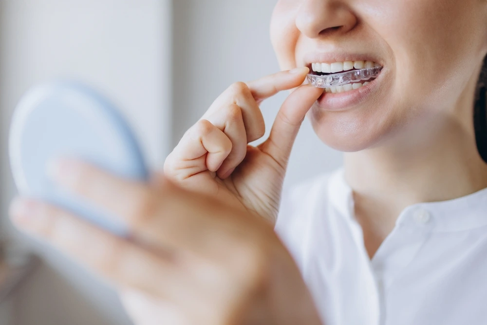 Aligners
