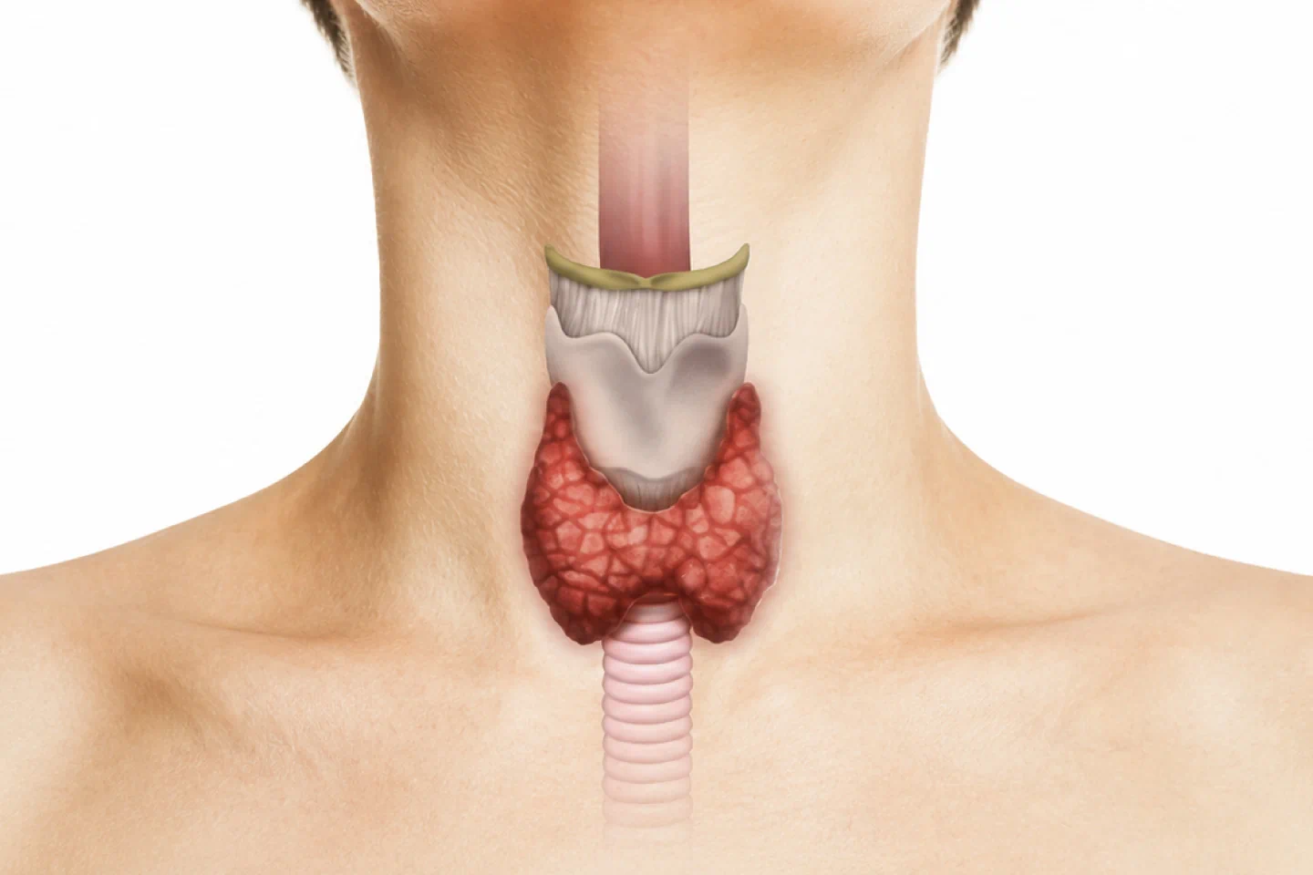 Thyroidectomy