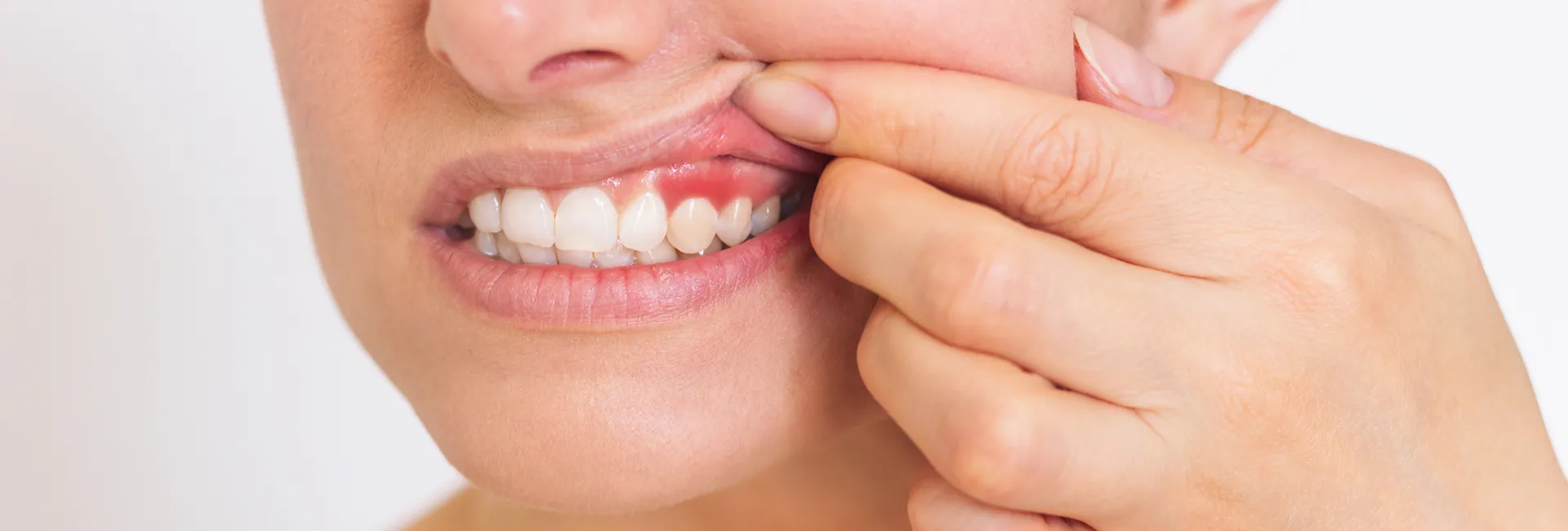 Early Signs of Gum Disease and How Periodontal Treatment Can Save Your Smile