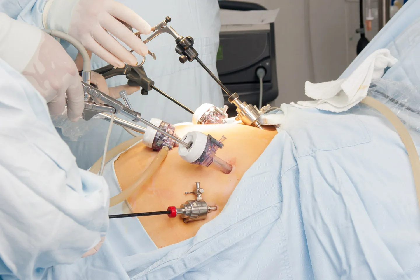 Uncovering the Truth Behind Bariatric Surgery