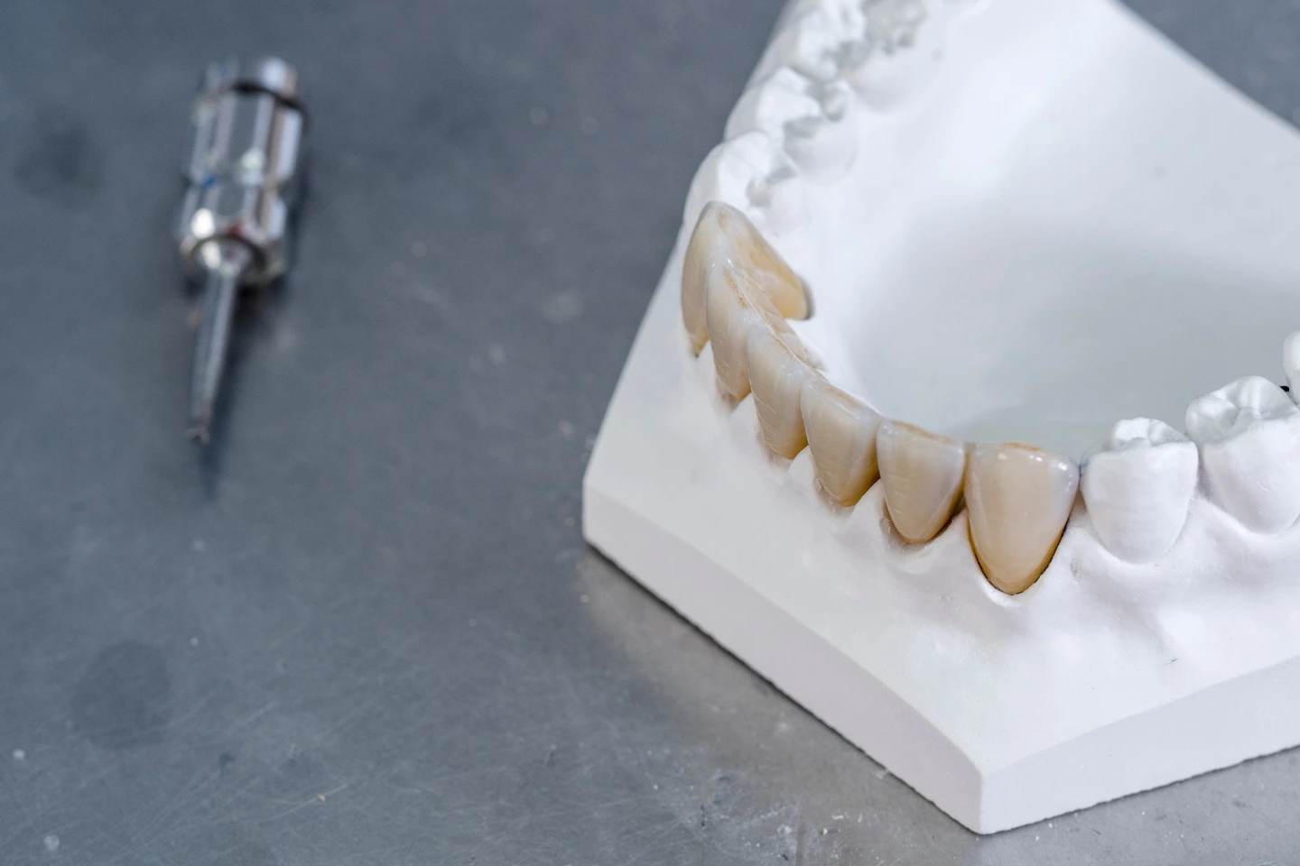 Zirconia vs. Acrylic for Full-Mouth Dental Implants