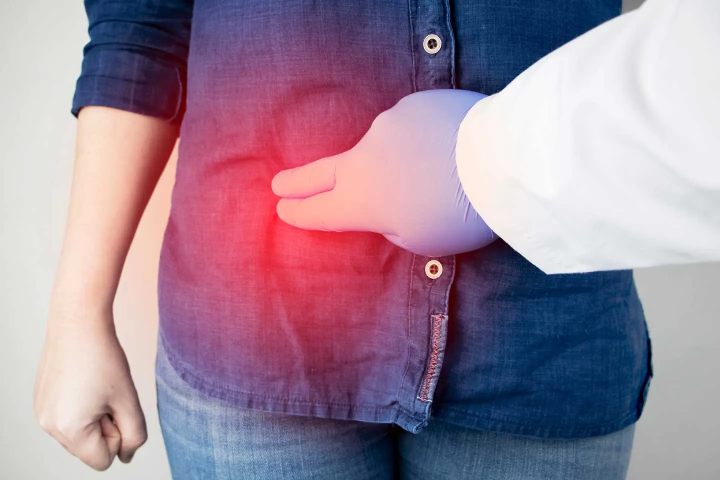 Laparoscopic Appendectomy: A Minimally Invasive Approach to Removing the Appendix