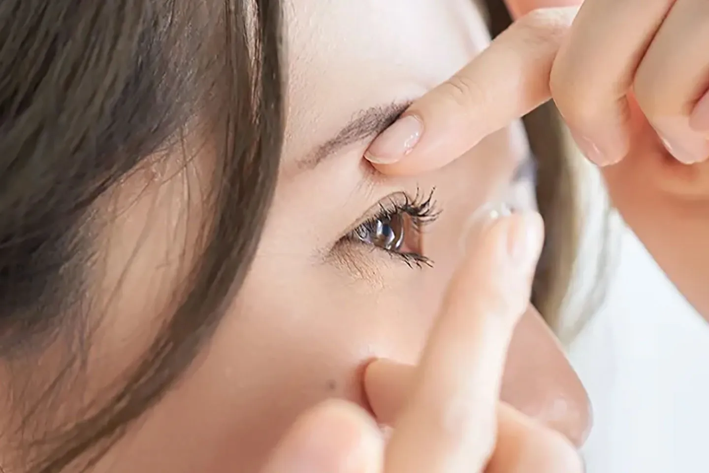 MiSight Contact Lenses for Myopia Correction