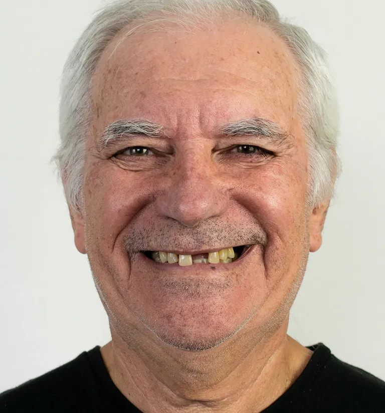 female in dental pain touching her teeth with hand hand