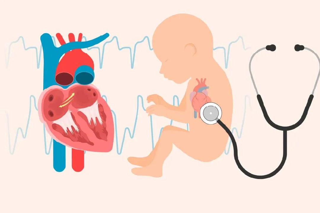 Congenital Heart Defect Repairs