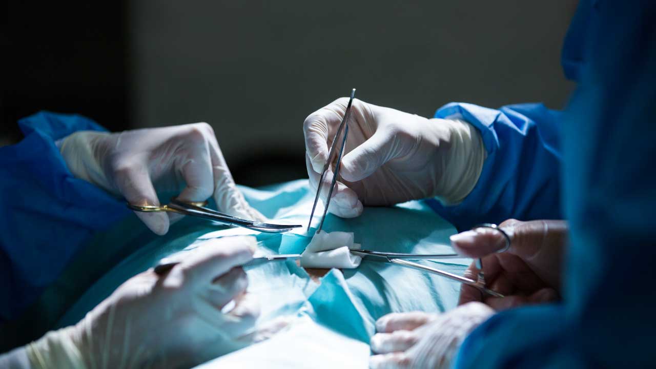 What to Expect During Laparoscopic Tubal Ligation